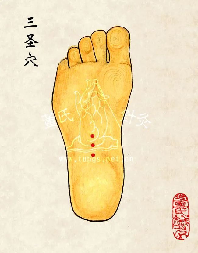 3. 针重魁穴,三圣穴,特效.