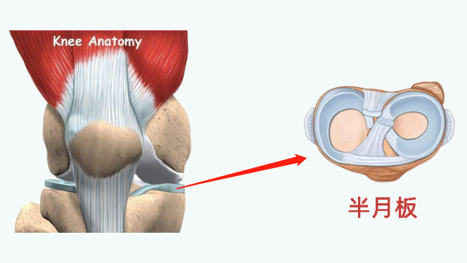 有些人年纪轻轻,但"半月板"已经撑不住了