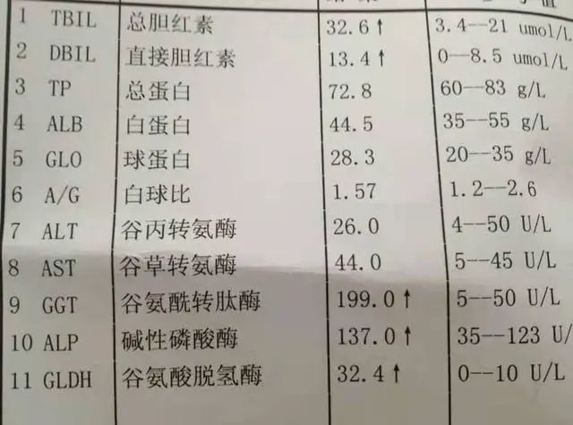 转氨酶,胆红素都升高,医生说没事,肝功能检查单怎么看