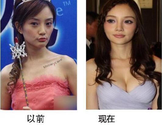辣妈李小璐的胸部二次发育之谜,当真是假奶?