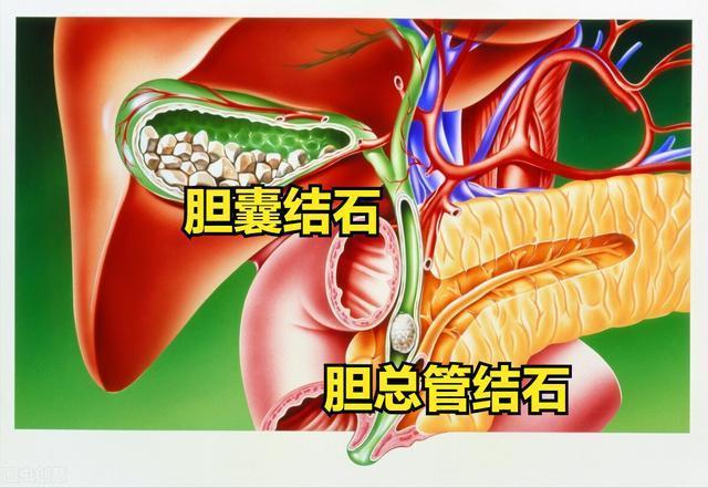 节食节出胆石症饿着撑着都危险