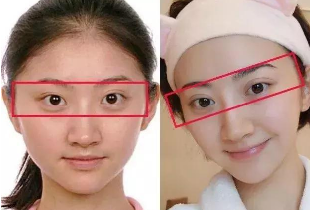 前后对比图到处都是 并且这也是明眼人都能看出来的变化 双眼皮让人有