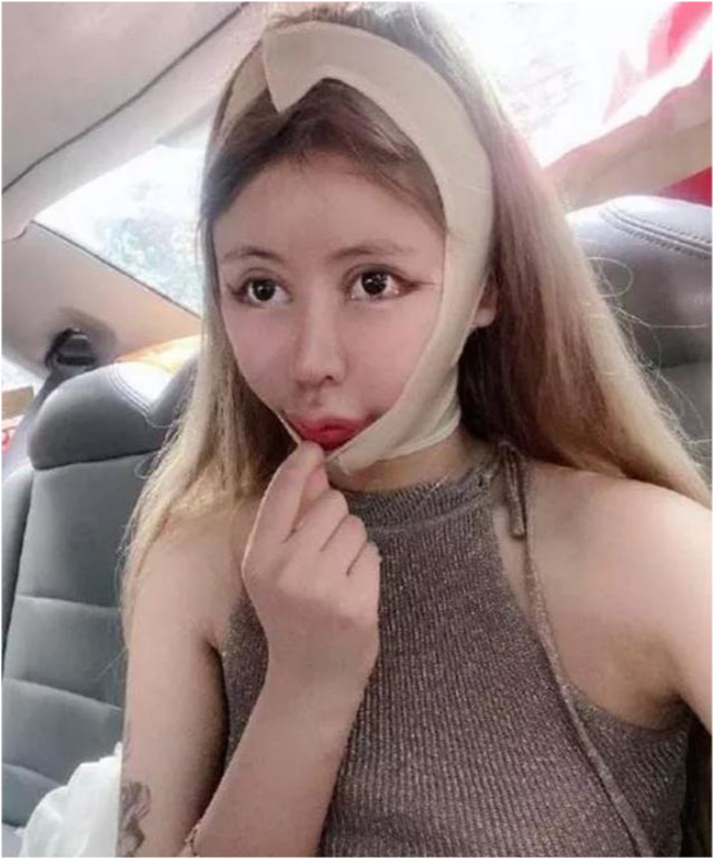 网红女孩娜娜3年整容60次花费上百万结局让人很意外