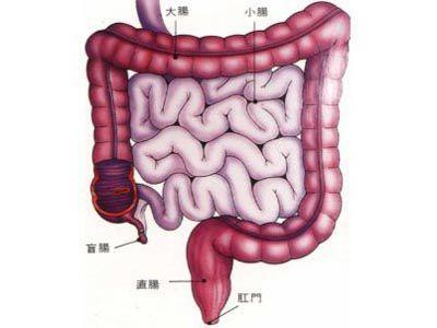 关于结肠癌常见陷阱有哪些?有结肠癌吃什么好 一定要知道的