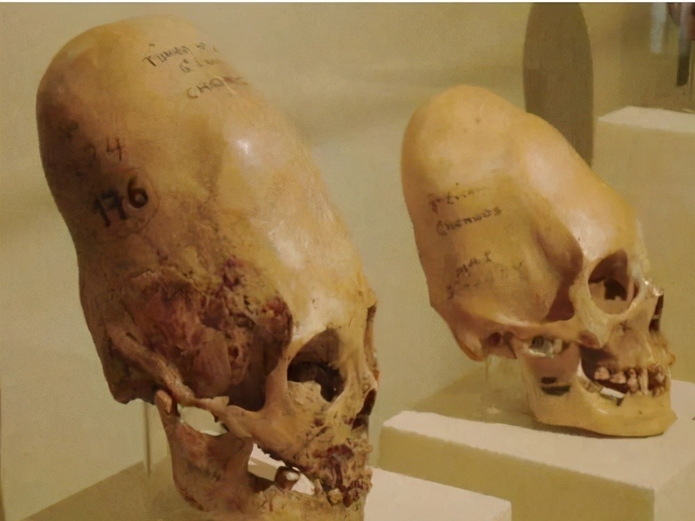 在一片荒芜中发现了一系列备受争议的人类遗骸头骨,大约有300多具