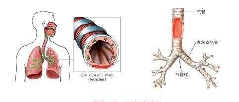 从中医角度来谈谈慢性支气管炎