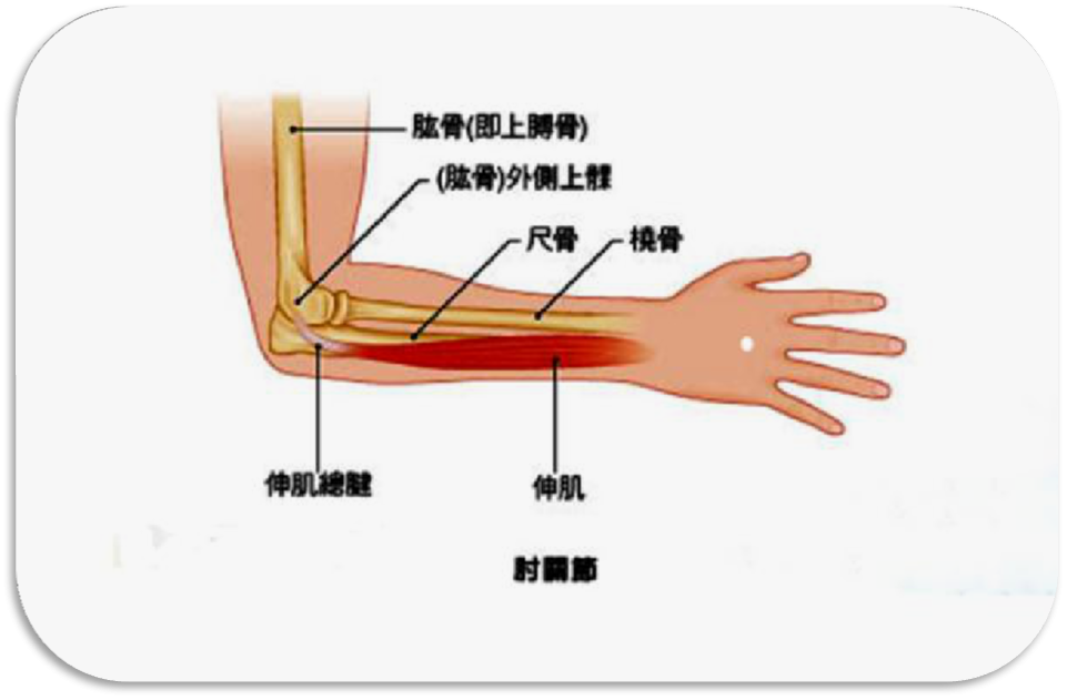 西医学中,肘劳多见于肱骨外上髁炎和尺骨 鹰嘴炎等疾病中.