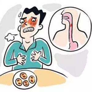 那么同样是咽喉有异物感,是慢性咽炎还是食道癌?医生说这样区分