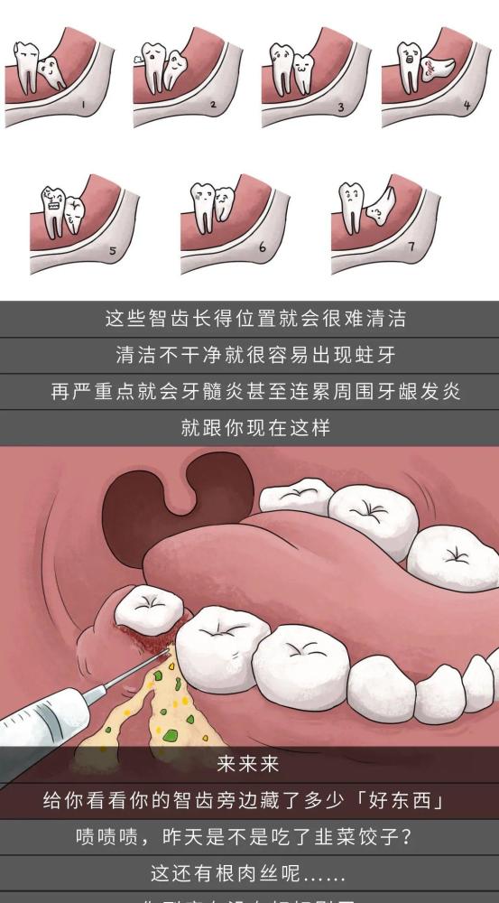 不拔智齿的人,你们会后悔的!