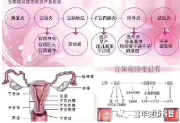 2,一般情况下,女性阴道内会存在大量的乳酸杆菌,这些细菌能使女性阴道