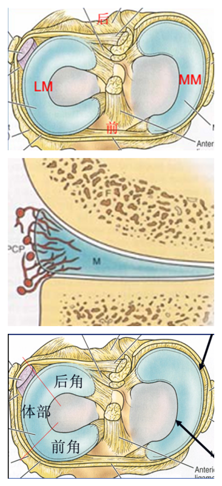 半月板为胫骨与股骨关节面之间的两片纤维软骨结构,前后两端借韧带
