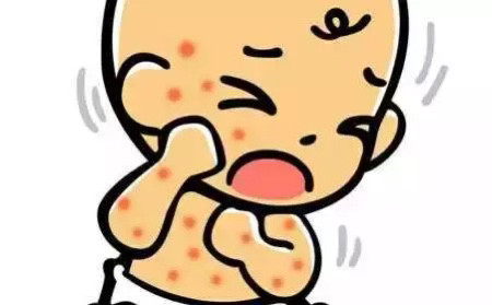 3.过敏性皮炎