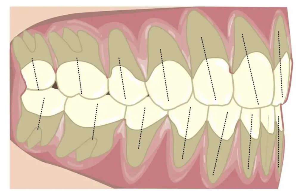 牙齿正常的咬合关系是在怎样的?