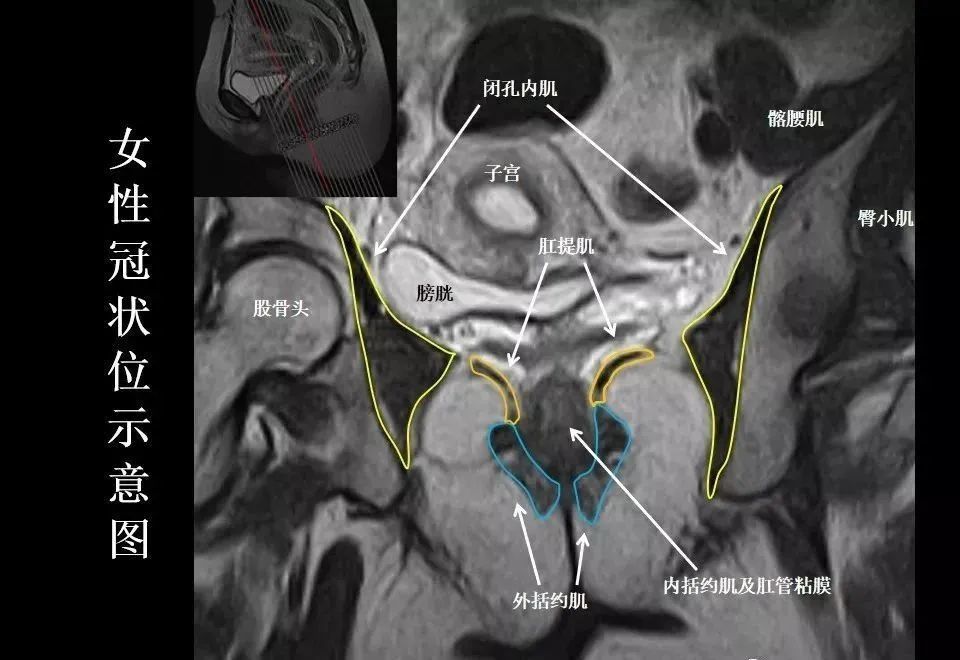 张8图带你熟悉盆底mri解剖