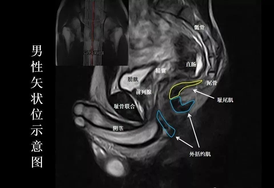 张8图带你熟悉盆底mri解剖