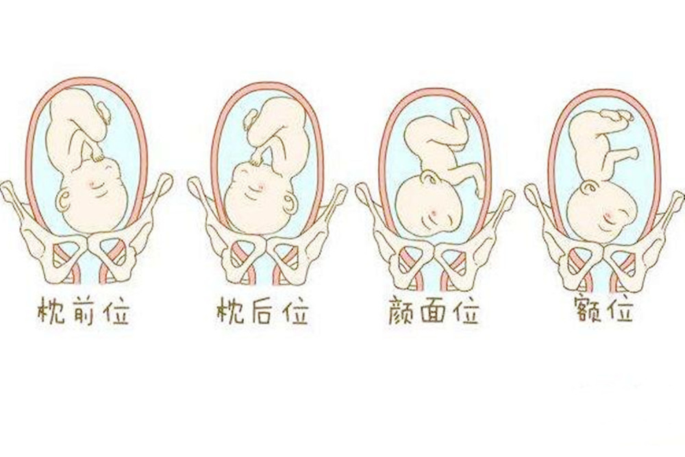 具体来说,就是胎儿的后脑勺在母亲的盆骨位置,并且在左前侧.