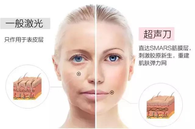 不要等热玛吉的副作用出现了才后悔热玛吉做完注意事项没有做好!