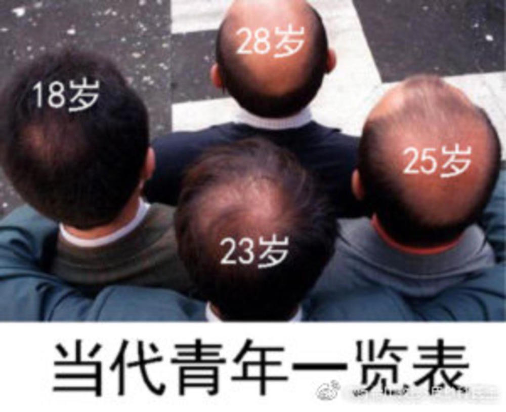 令人头秃!"最性感秃顶男"评选引热议,"秃"的背后竟有这么多奥秘