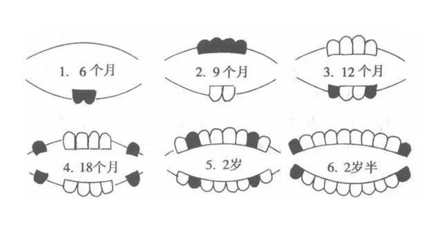 一般情况下乳牙大概萌出顺序:乳中切牙(1—乳侧切牙(2—第一乳
