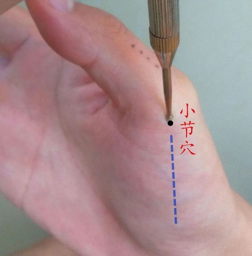 治疗腕肘痛,颈,肩,背,腰,腿,踝关节,坐骨神经痛,胸痛,胃痛,慢性腹泻.