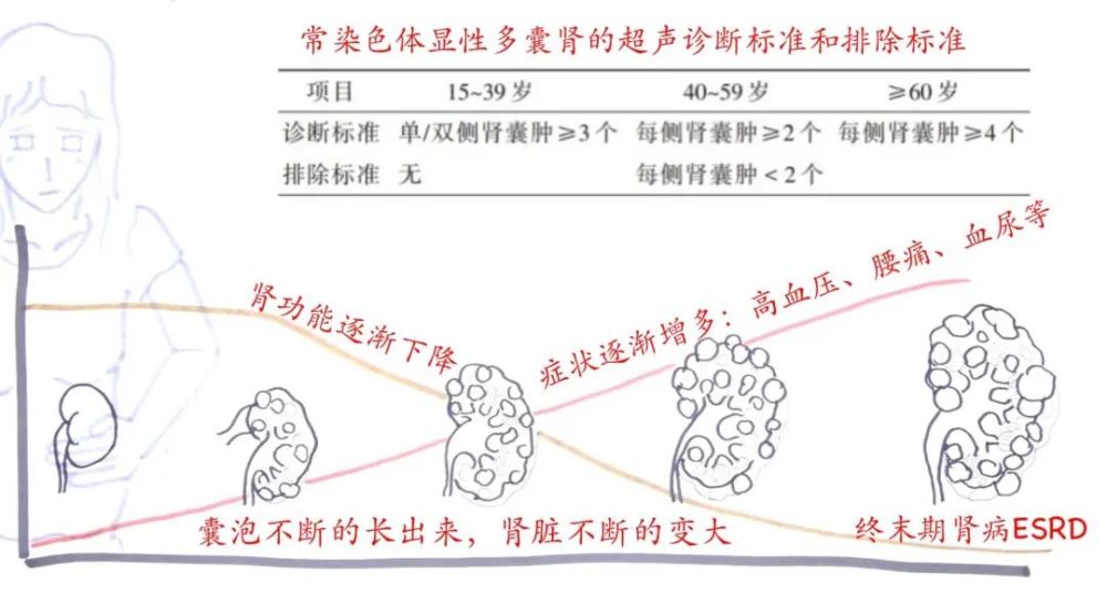 uptodate 常染色体显性遗传性多囊肾的肾脏表现3.