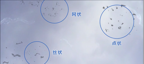 "飞蚊症"是一种什么表现?