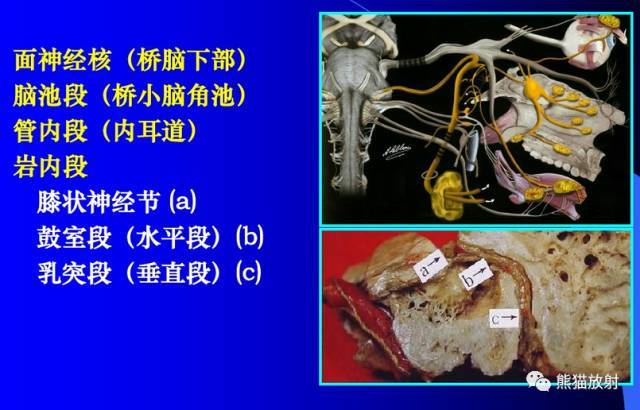 赶紧收藏最全颅神经mri断层解剖