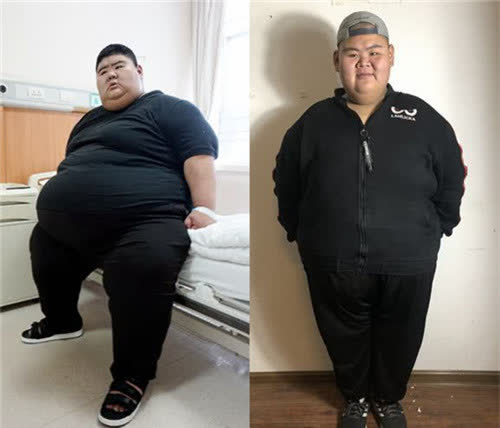 中国第一胖王浩楠:为爱1年减负400斤,老同学疑惑:帅哥