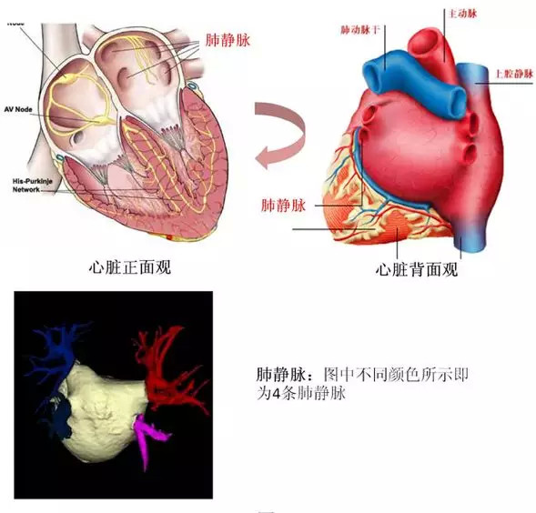 杨庆:冷冻消融pk射频消融,治疗房颤效果谁最佳?