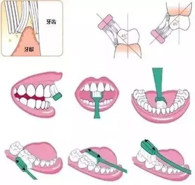 (巴氏刷牙法图示)