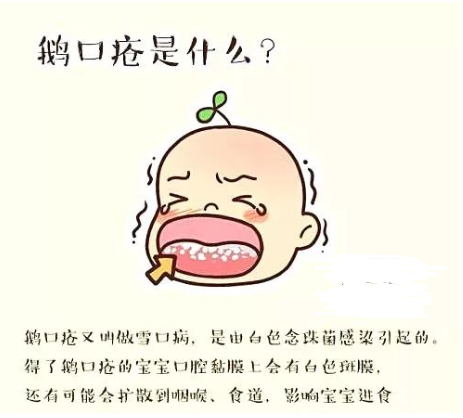 鹅口疮,它让宝宝难受哭闹,吃不下饭,最烦人的是——它居然还反复发作!