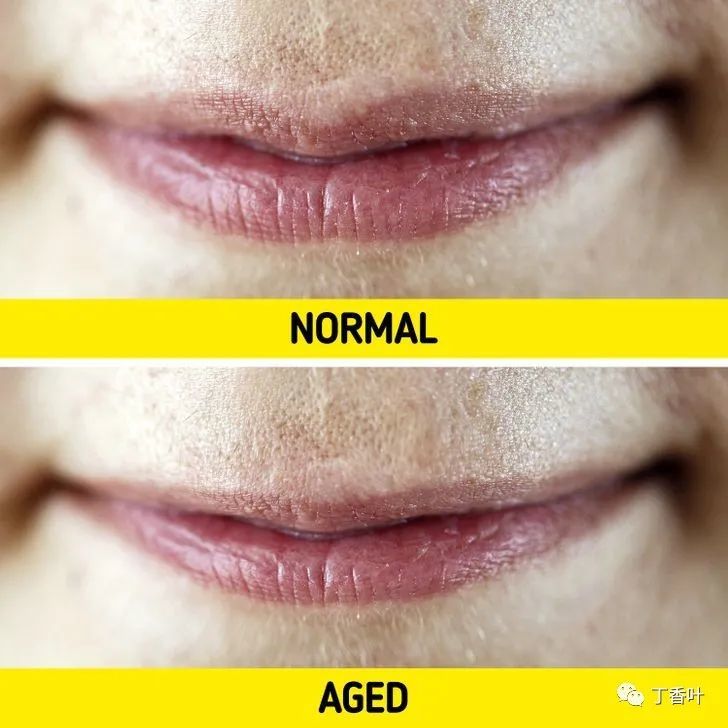 2 如果您发现二十多岁的嘴唇开始变稀,那么皮肤的衰老可能会比正常