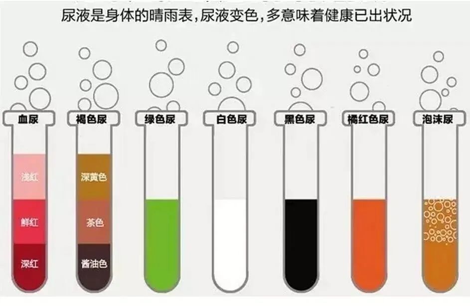 什么颜色的尿液是正常的?