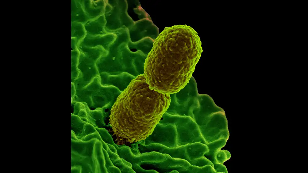 链球菌a型和b型各有不同链球菌隶属于厚壁菌门乳杆菌目,革兰氏染色