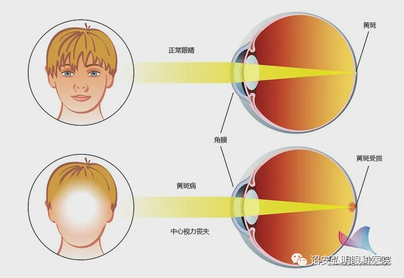 原来关灯玩手机对眼睛危害这么大.