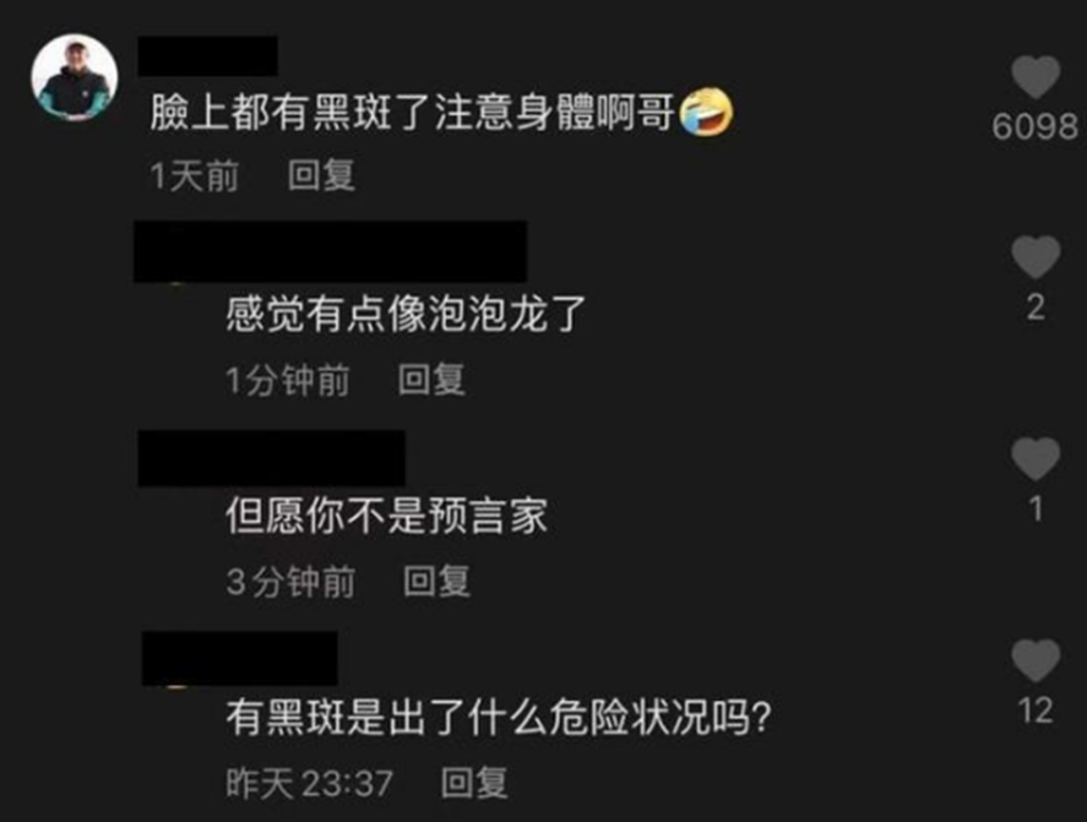 下一个泡泡龙?网红恩克脸上出现黑斑,胖到走路需要搀扶仍狂吃