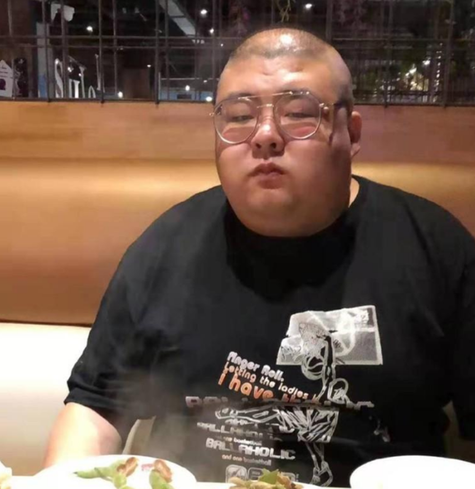 下一个泡泡龙?网红恩克脸上出现黑斑,胖到走路需要搀扶仍狂吃