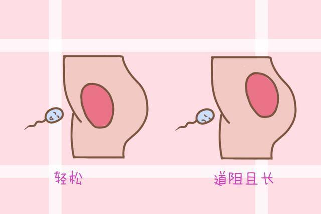 女性子宫位置,决定了怀孕的难易程度,有这四种情况的