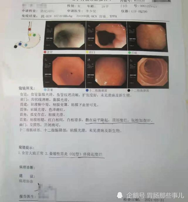 29岁查出萎缩性胃炎,很担心:会癌变吗?能治好吗?怎么预防?