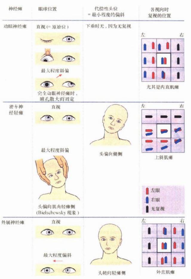 慧眼识人:一文道破眼球运动障碍
