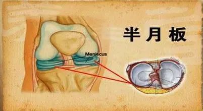 从超级网红带货主播薇娅半月板手术说开去