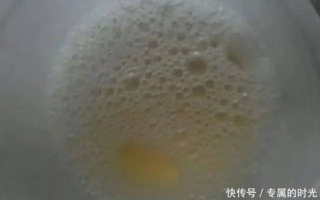 晨尿若有3个特点就偷着乐吧说明你的肾脏很不错