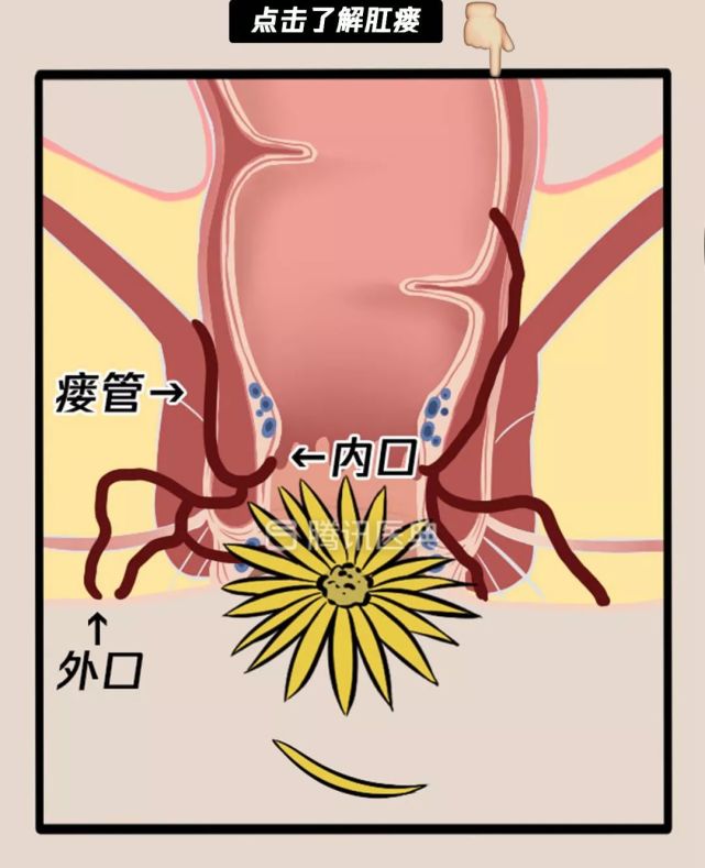 真实看病经历泣血奉上,必须保护好"菊花!