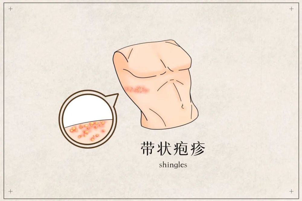 痛痛痛竟然比生小孩还要痛春天要小心