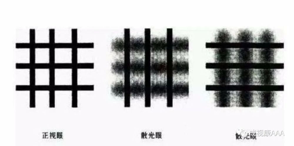 散光的危害