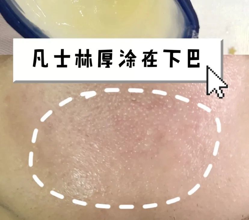 别怕,其实闭口没想象的那么可怕