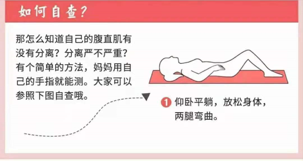 什么是腹直肌分离腹直肌分离的危害有哪些如何自测
