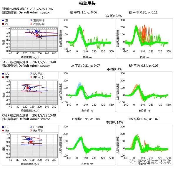 均正常;见左向自发眼震,约4°/s,摇头见左向眼震,约8°/s;冷热试验示