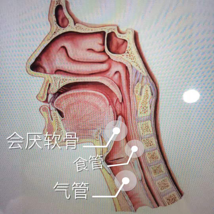 "咽喉要塞"会厌部示意图