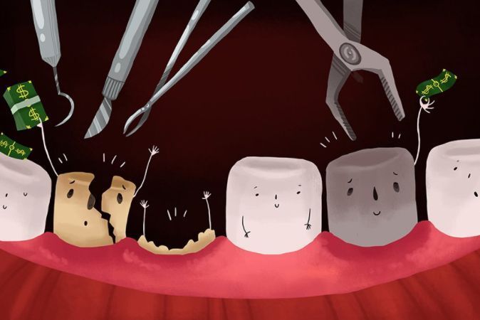 【深圳拔牙】拔牙后怎样判断伤口是正常反应还是干槽症呢?